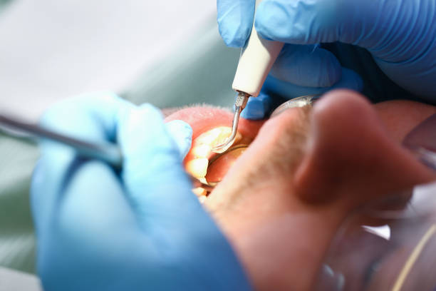 Best Emergency Broken Tooth Repair in Armona, CA
